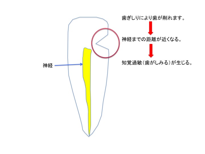 顎が痛い理由