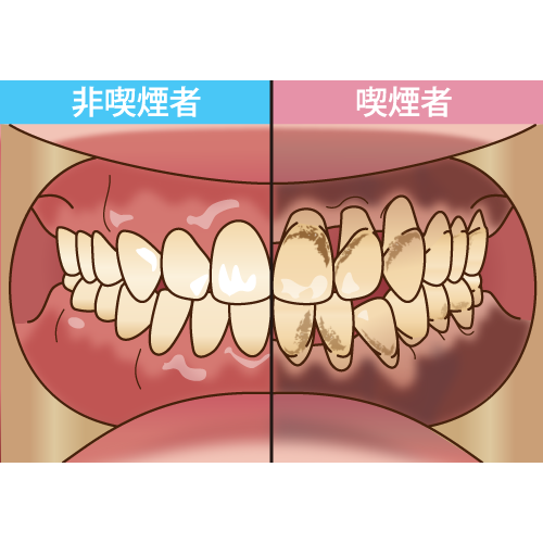 タバコはなぜいけないの？