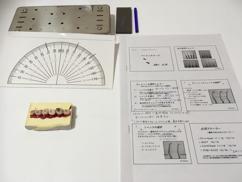 歯石とりって何やってるの？